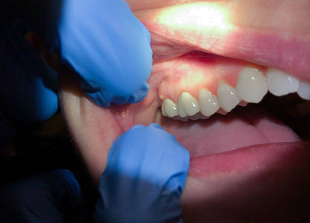 Best Root Canal Emergency Dentist  in Bethalto, IL