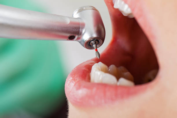 Best Knocked-Out Tooth Emergency  in Bethalto, IL